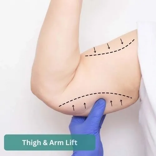 Body Contouring before and after result 1 by Dr Amr Khalil, Manchester