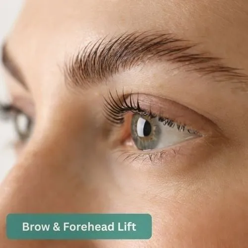 Brow & Forehead Lift before and after result 1 by Dr Amr Khalil, Manchester